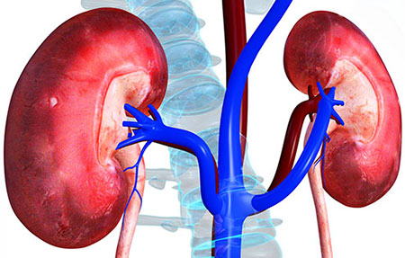 Santé : la transplantation rénale  bientôt appliquée au Sénégal