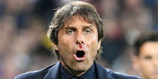 Furieux, Conte allume ses dirigeants !