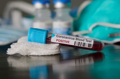 CORONAVIRUS - Un nouveau cas déclaré positif, le bilan passe à 27 infectés