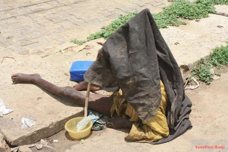 SANTÉ MENTALE AU SÉNÉGAL- 8 régions sur 14 disposent d’un service de psychiatrie