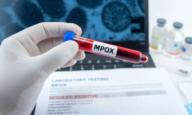 PREMIER CAS IMPORTÉ DE DÉTECTÉ AU SENEGAL – Ce qu’il faut savoir sur le Mpox