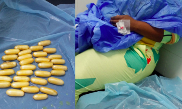 TRAFIC DE DROGUE - Une Sud-africaine interceptée à l'aéroport expulse 92 boulettes de cocaïne