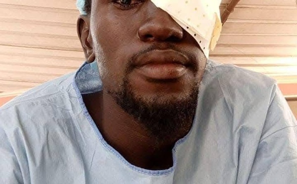 UNIVERSITÉ IBA DER THIAM - L’étudiant Mady Ndiaye perd un œil dans les affrontements