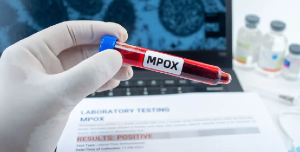 MPOX -  Deux nouveaux cas confirmés au Sénégal, portant le total à quatre