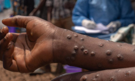 MPOX - Le Sénégal annonce la guérison de "son" cas importé